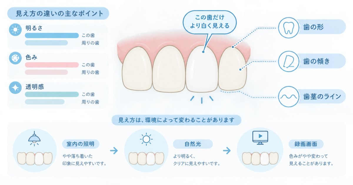 前歯のセラミックが白すぎて浮くのはなぜ?